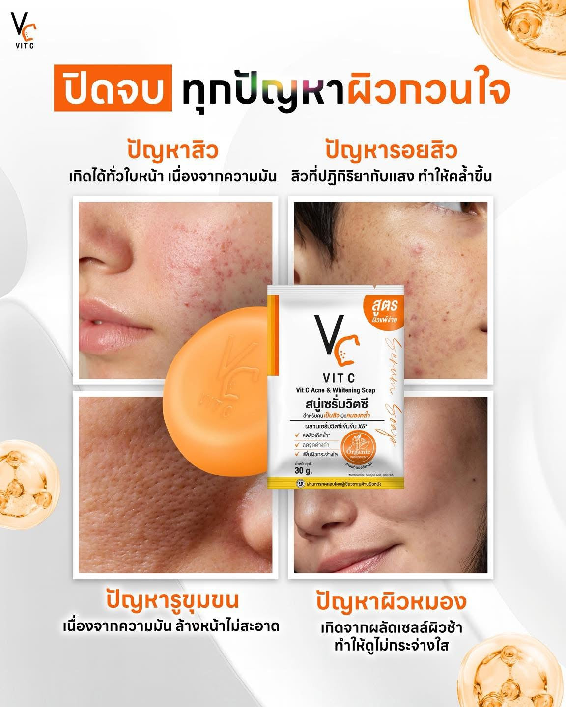 VC Vit C Ance & Whitening Soap 30g