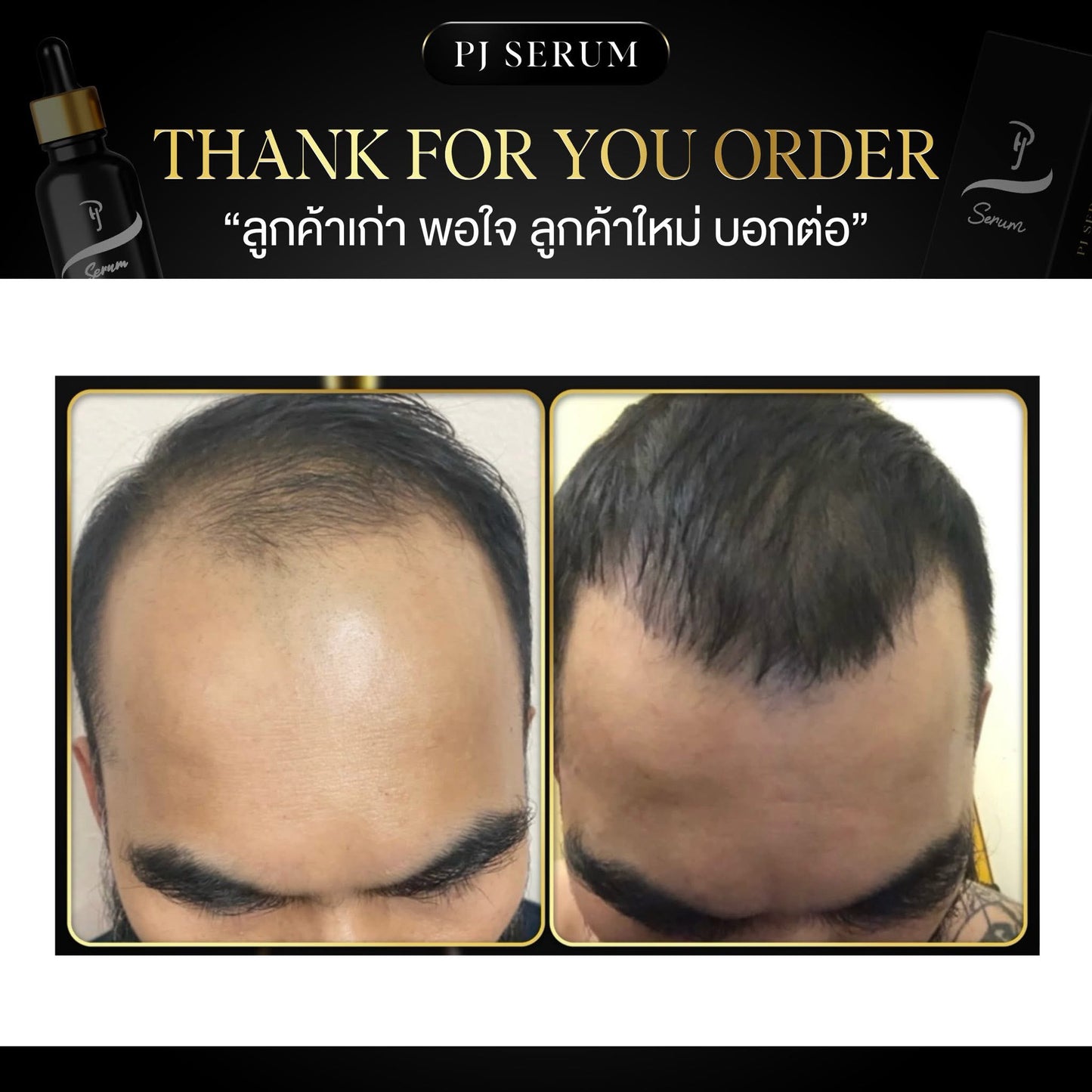 Pj Serum